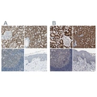 Immunohistochemical staining of human kidney, liver, lymph node and skin using Anti-ACADM antibody HPA006198 (A) shows similar protein distribution across tissues to independent antibody HPA026542 (B).