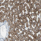 Anti-ACADM Antibody