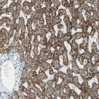 Immunohistochemical staining of human liver shows strong granular cytoplasmic positivity in hepatocytes.