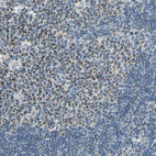 Anti-ACADM Antibody