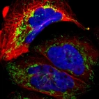 Immunofluorescent staining of human cell line A-431 shows localization to mitochondria.