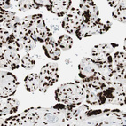 Anti-MTA2 Antibody