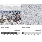 Anti-MTA2 Antibody