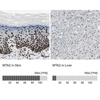 Immunohistochemistry analysis in human skin and liver tissues using HPA006214 antibody. Corresponding MTA2 RNA-seq data are presented for the same tissues.