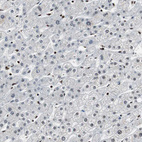 Anti-MTA2 Antibody