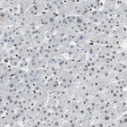 Immunohistochemical staining of human liver shows very weak nuclear positivity in hepatocytes.
