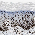 Immunohistochemical staining of human skin shows strong nuclear positivity in squamous epithelial cells.