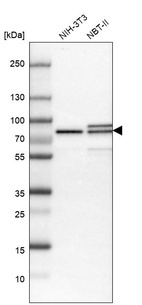 Anti-MTA2 Antibody