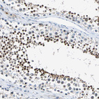 Anti-HCFC2 Antibody