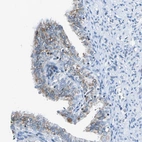 Immunohistochemical staining of human fallopian tube shows weak cytoplasmic positivity in glandular cells.