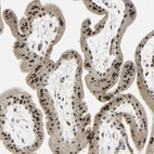Immunohistochemical staining of human Placenta shows strong nuclear positivity in trophoblastic cells.