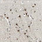 Immunohistochemical staining of human Cerebral cortex shows strong nuclear positivity in neuronal cells.