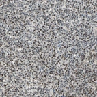 Immunohistochemical staining of human Lymph node shows moderate nuclear positivity in non-germinal center and germinal center cells.