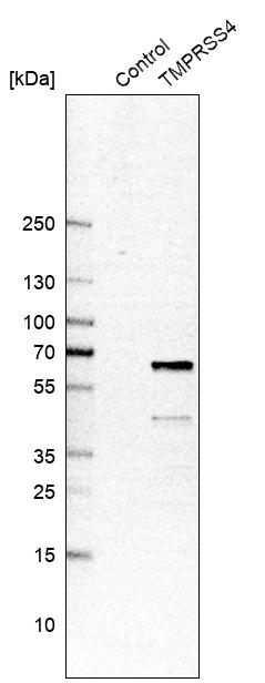 Anti-TMPRSS4 Antibody