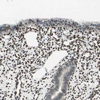 Immunohistochemical staining of human endometrium shows strong nuclear positivity in stromal cells.