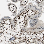 Immunohistochemical staining of human placenta shows strong nuclear positivity in stromal cells.