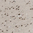 Immunohistochemical staining of human cerebral cortex shows strong nuclear positivity in neurons.