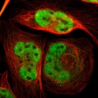 Immunofluorescent staining of human cell line U-2 OS shows localization to nucleoplasm.