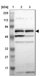 Lane 1: Marker [kDa] 229, 112, 84, 48, 32, 27, 17_br/_Lane 2: Human cell line RT-4_br/_Lane 3: Human cell line U-251MG sp