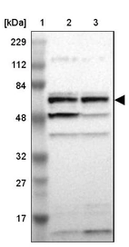 Lane 1: Marker [kDa] 229, 112, 84, 48, 32, 27, 17_br/_Lane 2: Human cell line RT-4_br/_Lane 3: Human cell line U-251MG sp