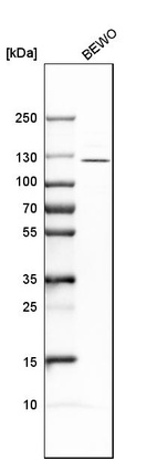 Western blot analysis in human cell line BEWO.