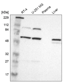 Western blot analysis in human cell line RT-4, human cell line U-251 MG, human plasma and human liver tissue.