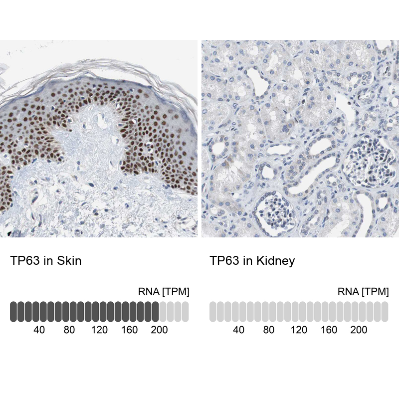 Anti-TP63 Antibody