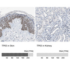 Anti-TP63 Antibody