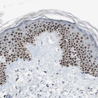 Immunohistochemical staining of human skin shows strong nuclear positivity in squamous epithelial cells.