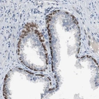 Immunohistochemical staining of human prostate shows strong nuclear positivity in basal glandular cells.