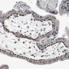 Immunohistochemical staining of human placenta shows strong nuclear positivity in cytotrophoblasts.