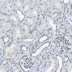 Immunohistochemical staining of human kidney shows no nuclear positivity in cells in tubules as expected.