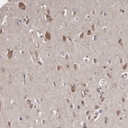 Anti-CELF3 Antibody