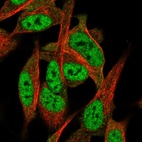 Immunofluorescent staining of human cell line SH-SY5Y shows localization to nucleoplasm.