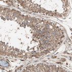 Immunohistochemical staining of human testis shows moderate cytoplasmic positivity in cells in seminiferous ducts.