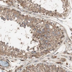 Immunohistochemical staining of human testis shows moderate cytoplasmic positivity in cells in seminiferous ducts.