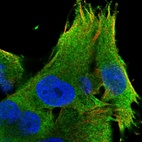 Immunofluorescent staining of human cell line SK-MEL-30 shows localization to plasma membrane.