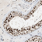 Anti-SIRT1 Antibody