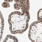 Immunohistochemical staining of human placenta shows strong nuclear positivity in trophoblastic cells.