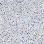 Immunohistochemical staining of human liver shows very weak cytoplasmic positivity in hepatocytes.