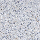 Immunohistochemical staining of human liver shows very weak cytoplasmic positivity in hepatocytes.