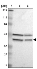 Lane 1: Marker [kDa] 229, 112, 84, 48, 32, 27, 17_br/_Lane 2: Human cell line RT-4_br/_Lane 3: Human cell line U-251MG sp