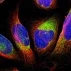 Immunofluorescent staining of human cell line U-2 OS shows localization to endoplasmic reticulum.