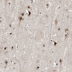 Anti-CDC5L Antibody