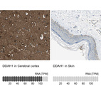 Anti-DDAH1 Antibody