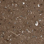 Immunohistochemical staining of human cerebral cortex shows strong cytoplasmic positivity in neuronal cells and neuropils.