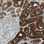 Immunohistochemical staining of human kidney shows strong cytoplasmic positivity in cells in tubules.