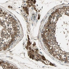 Immunohistochemical staining of human testis shows strong cytoplasmic positivity in Leydig cells.