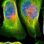 Immunofluorescent staining of human cell line U-2 OS shows localization to plasma membrane & cytosol.