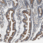 Anti-GSTK1 Antibody